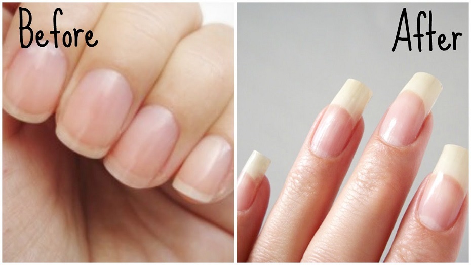 can you make your nail beds longer